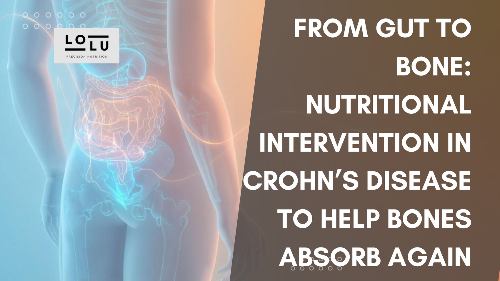 From Gut to Bone: Nutritional Intervention in Crohn’s Disease to Help Bones Absorb Again